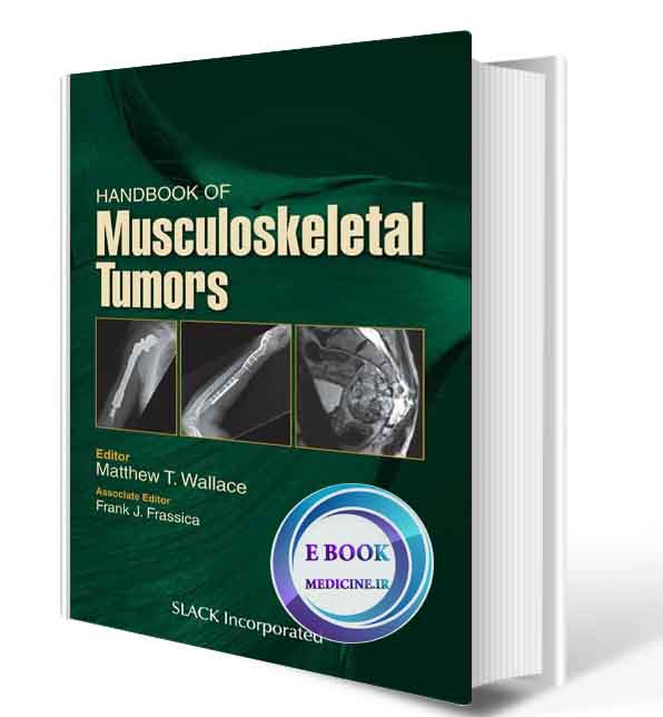 دانلود کتاب Handbook of Musculoskeletal Tumors 1st 2020 (ORIGINAL PDF)